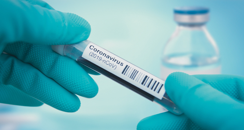 Blutprobe mit der Aufschrift Coronavirus in den Händen